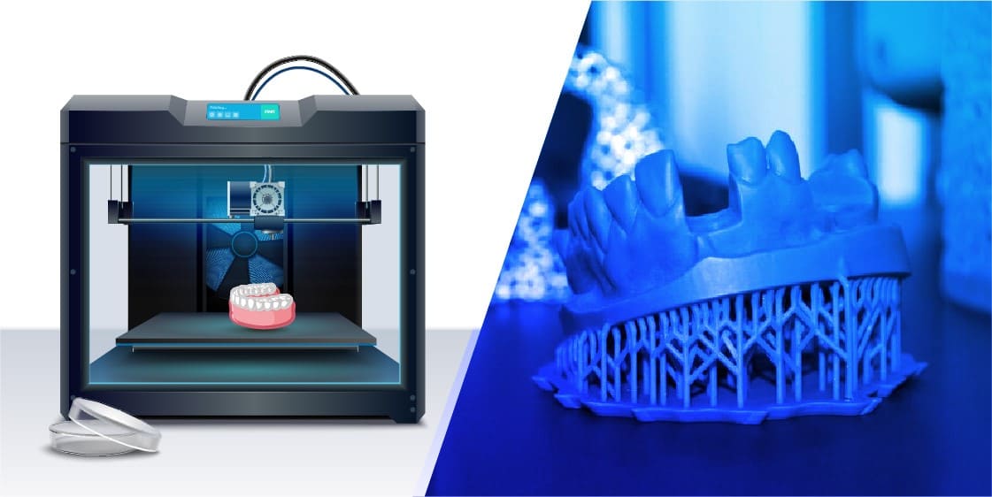 3D Printing an Emerging Technology for Dentistry and Dental Surgery