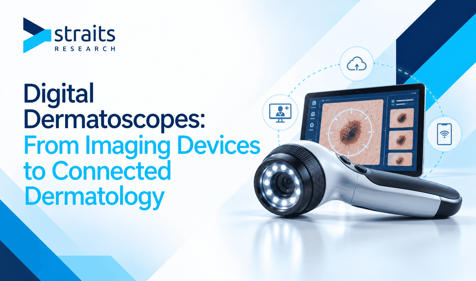 Digital Dermatoscopes: From Imaging Devices to Connected Dermatology